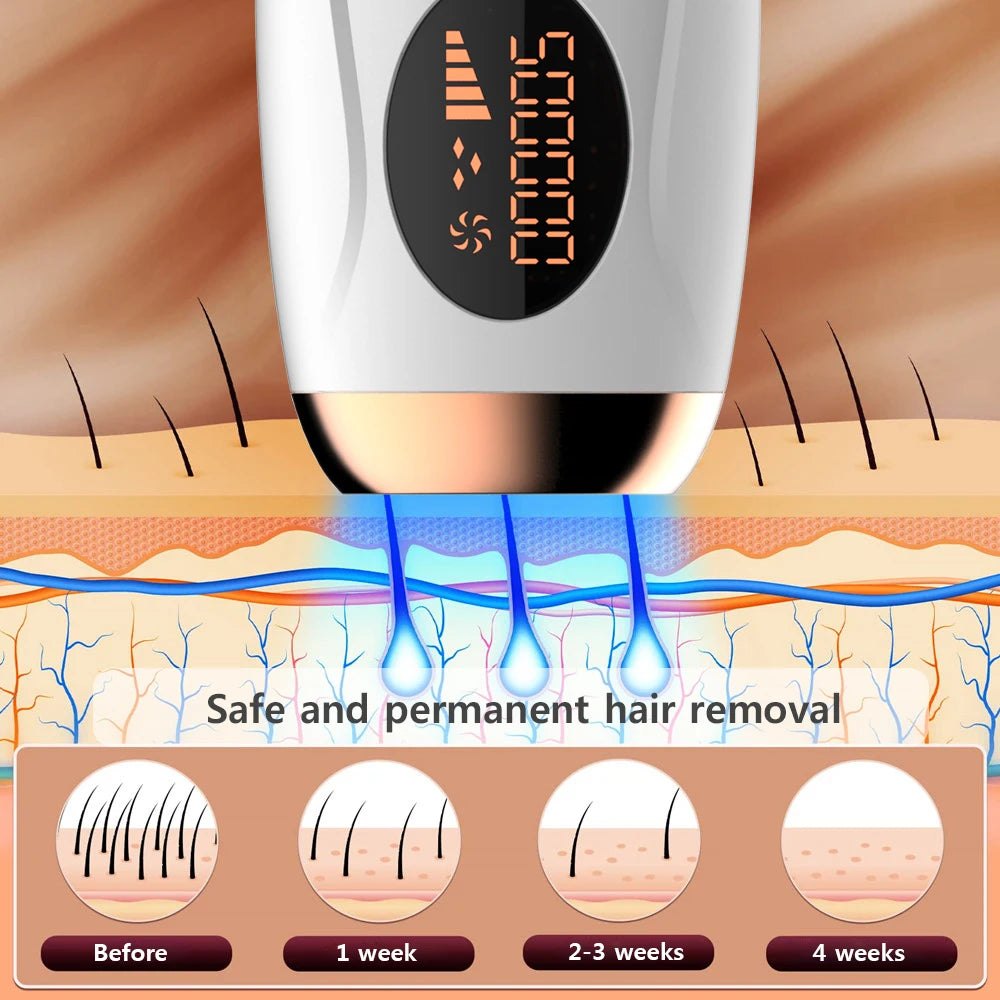 Painless IPL Laser Epilator